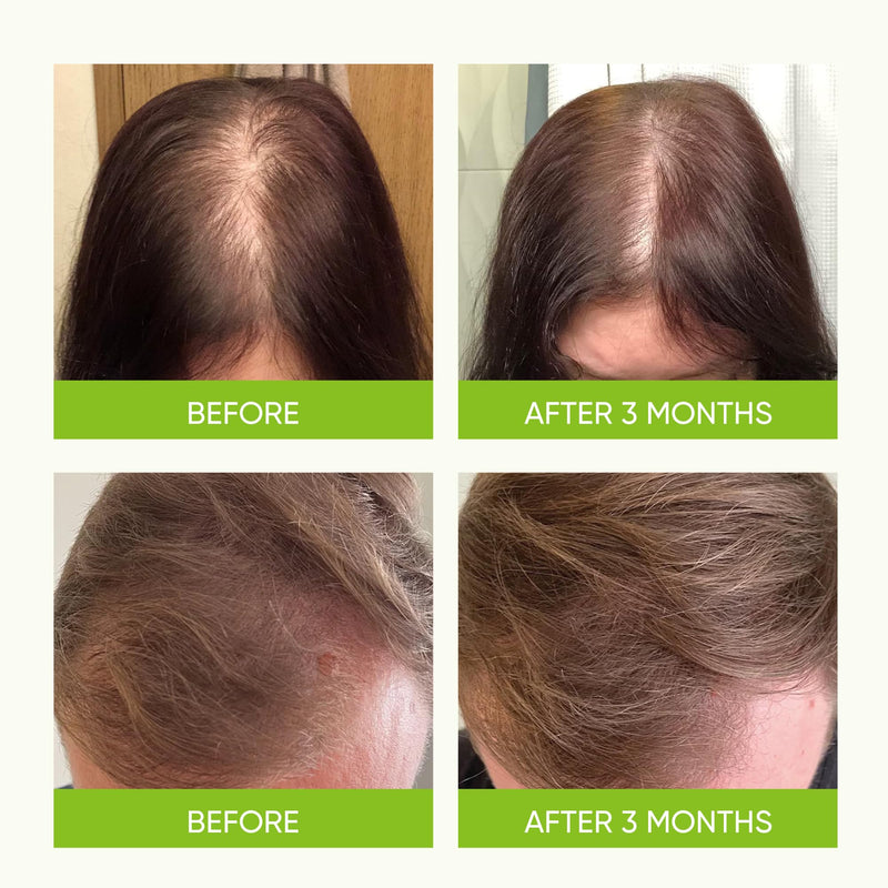 Hair Growth Serum Spray - with Rosemary Batana Oil Biotin for Hair Loss and Thinning Hair - Thicker Fuller Hair for Women Men 2 Fl Oz (Pack of 1) 2 Fl Oz (Pack of 1)