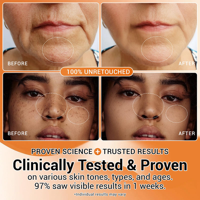 30% Vitamin C Serum with Hyaluronic Acid & Rose Stem Cells – Enhances Anti-Aging Face Serum for Wrinkles, Uneven Skin Tone, Dark Spots, Dull Skin，Korean Microneedling-Like Care 30 Ampoules Vitamin C Collagen Serum 30pcs