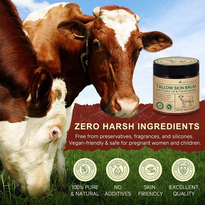 2 Pcak Beef Tallow Cream with Castor Oil and Frankincense, 100% Grass-Fed Tallow for Skin Care, Face & Body Moisturizer for Skin, Sensitive Skin & Dry Skin Age Defying, Eczema All-Purpose Balm Beef Tallow with Frankincense 2 Pack