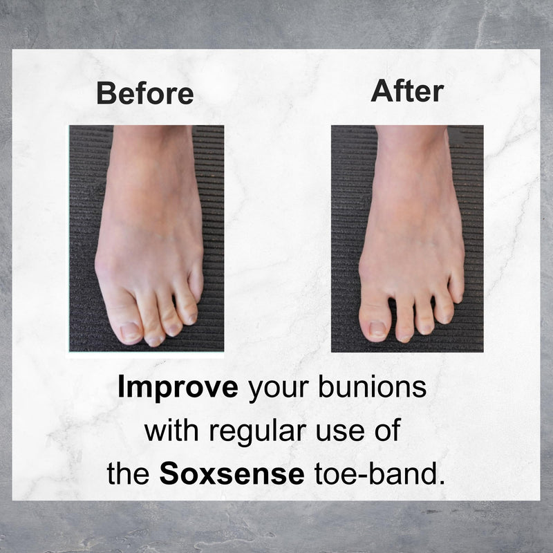 [Australia] - Soxsense Toe Bands for Bunions, Big Toe Separator from Second Toe/Toe Exercise & Stretch Bands Lightweight & Heavyweight (2 Bands) 