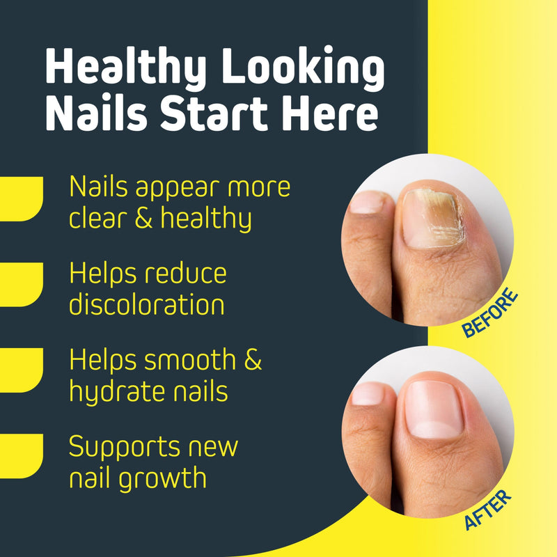 Nail Repair & Renewal Pen for Thick, Discolored & Brittle Nails