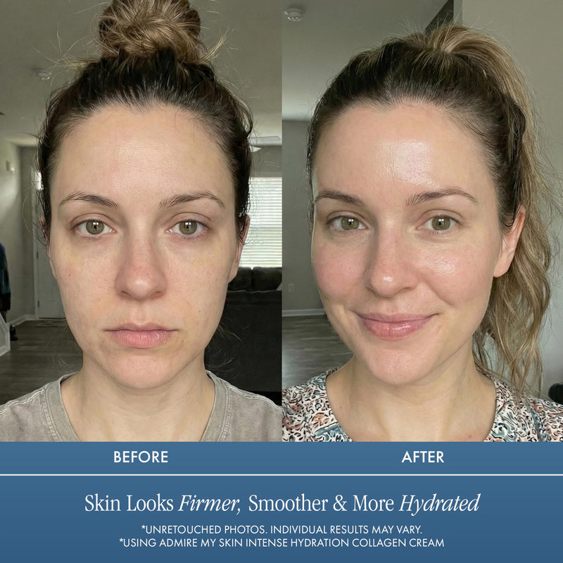 Admire My Skin Intense Hydration Collagen Cream Moisturizer 2oz | Hydrating Hyaluronic Acid Face Cream, Non Comedogenic Youthful Glow Formula for Dull Dry Skin 2 Fl Oz (Pack of 1)