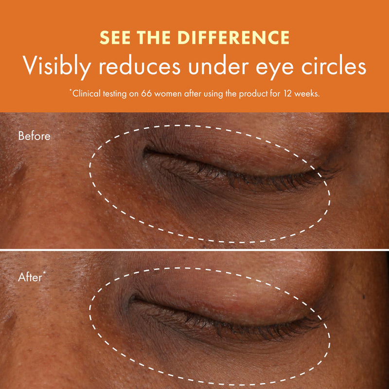 Origins GinZing Brightening Eye Cream with Vitamin C & Niacinamide| Visibly Reduces Dark Circles, 0.5 Fl Oz Warm - (medium-to-deep skin tones and warmer undertones)