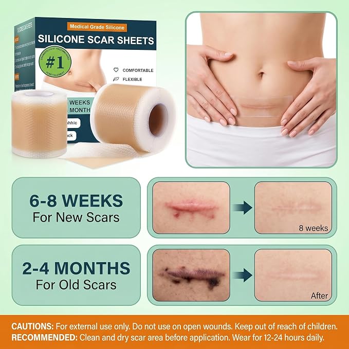 Silicone Scar Sheets, Silicone Scar Tape (1.6"x 60" Roll-1.5M), Reusable and Effective Scar Removal Sheets, Silicone Scar Removal Sheets for Surgical Scars, Healing Keloid, C-Section, Tummy Tuck