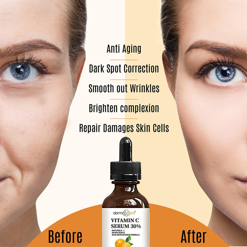 30% Vitamin C Serum for Face, Hyaluronic Acid + Vitamin (B3 + E) + Jojoba + Aloe Vera- Natural & Organic Anti Wrinkle & Skin Rejuvenator Moisturizer Vitamin C for All Skin - (2 FL OZ) 2 Fl Oz (Pack of 1)
