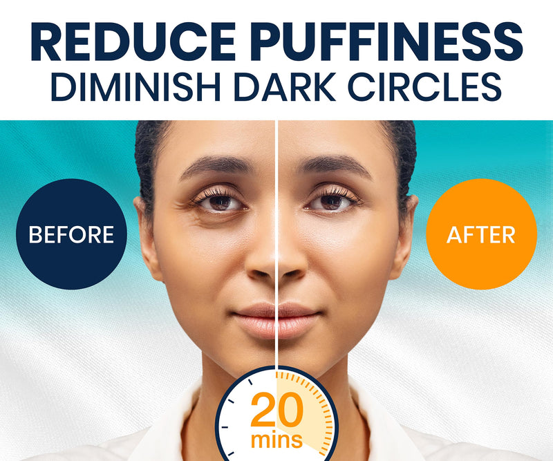 [Australia] - Under Eye Patches for Dark Circles and Puffy Eyes (30 Pairs), Marine Collagen Eye Gel Pads for Puffiness with Vitamin C, Hyaluronic Acid, and Pearl Extract, Eye Mask for Dark Circles and Puffiness 30 Count (Pack of 1) 
