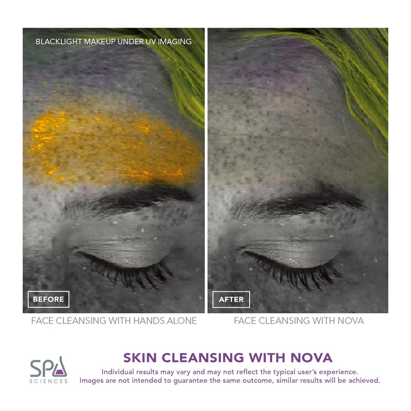 [Australia] - Spa Sciences - NOVA - Sonic Cleansing Brush with Bristles & Infusion System – Anti-Aging Facial Exfoliating, Waterproof, and USB Rechargeable Pink 