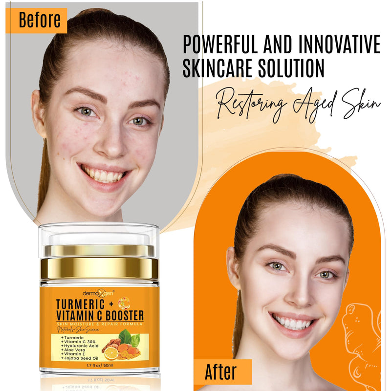 Turmeric Face Cream with 30% Vitamin C – Glow Booster, Anti-Aging & Skin Repair Moisturizer for Dark Spots, Hydration & Radiance – Vitamin C Cream for All Skin Types (1.7 fl oz) Turmeric Booster Cream