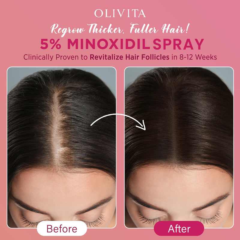 5% Minoxidil Spray for Women Hair Growth: Extra Strength Hair Regrowth Treatment – Revitalize Hair Follicles & Regrow Thicker, Fuller Hair – Hair Loss Solution - 2 Packs 2 Fl Oz (Pack of 2)