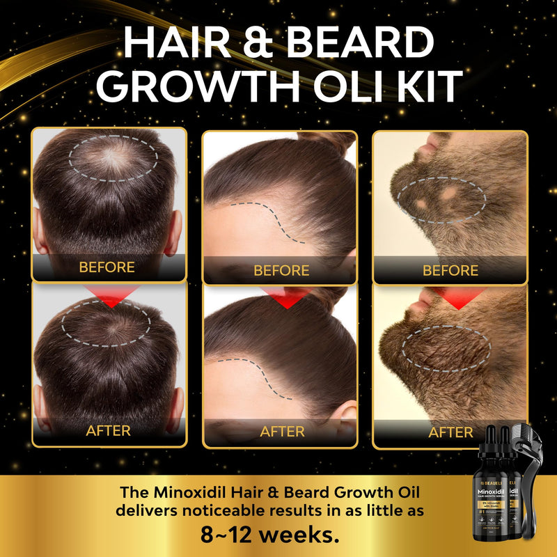 Beaueli Minoxidil Beard Growth Kit For Men and Women, Hair Loss and Hair Regrowth Treatments, Minoxidil 5%, Black 60ml 2 Bottles 2 Fl Oz (Pack of 2)