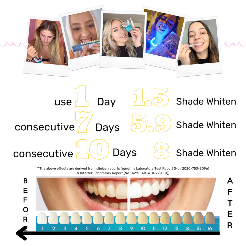[Australia] - Sparkle Booster Teeth Whitening Kit - 2 x 5ml Pap Whitening Gel Syringes - Includes Rechargeable LED Whitening Device, Shade Guide & Remineralization Pen - 10 to 15 Days Treatment 