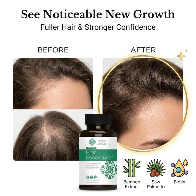 Natural Wellbeing Hair Essentials – DHT Blocker Hair Growth Supplement for Women & Men – Saw Palmetto, Biotin, – Vegan Capsules – Stops Shedding & Thinning (90 Count, 1-Month Supply) 90 Count (Pack of 1)