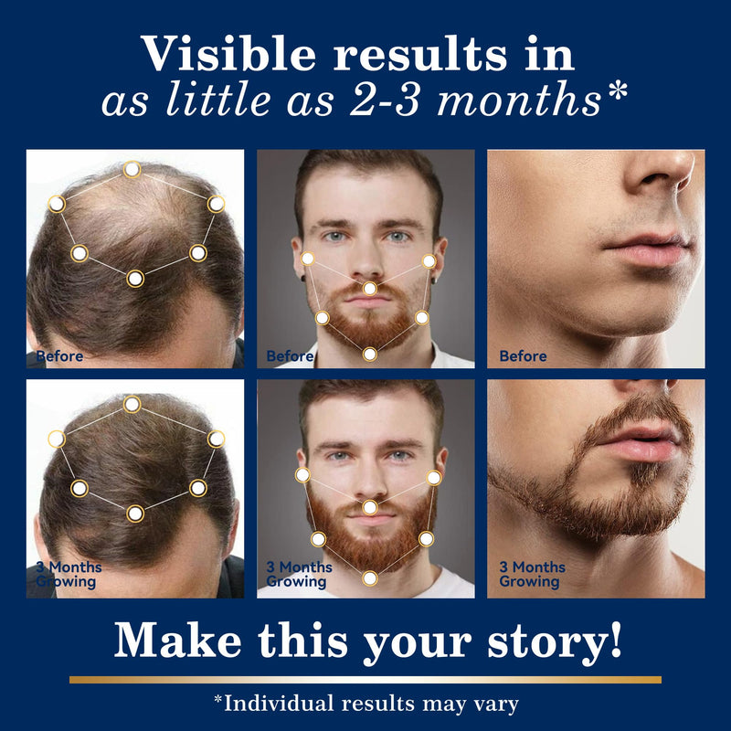 5% Minoxidil Hair & Beard Regrowth Spray Kit for Men & Women, 2 x 1 fl oz | Extra Strength topical solution treatment for hair loss and thinning areas, designed for controlled and convenient daily use.