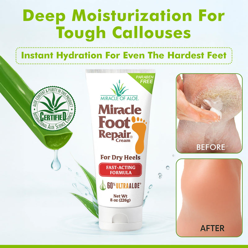 [Australia] - Miracle Foot Repair Cream (8 oz / 2-Pack) Repairs Dry Cracked Heels and Feet, 60% Pure UltraAloe Moisturizes, Softens, and Repairs 8 Ounce (Pack of 2) 