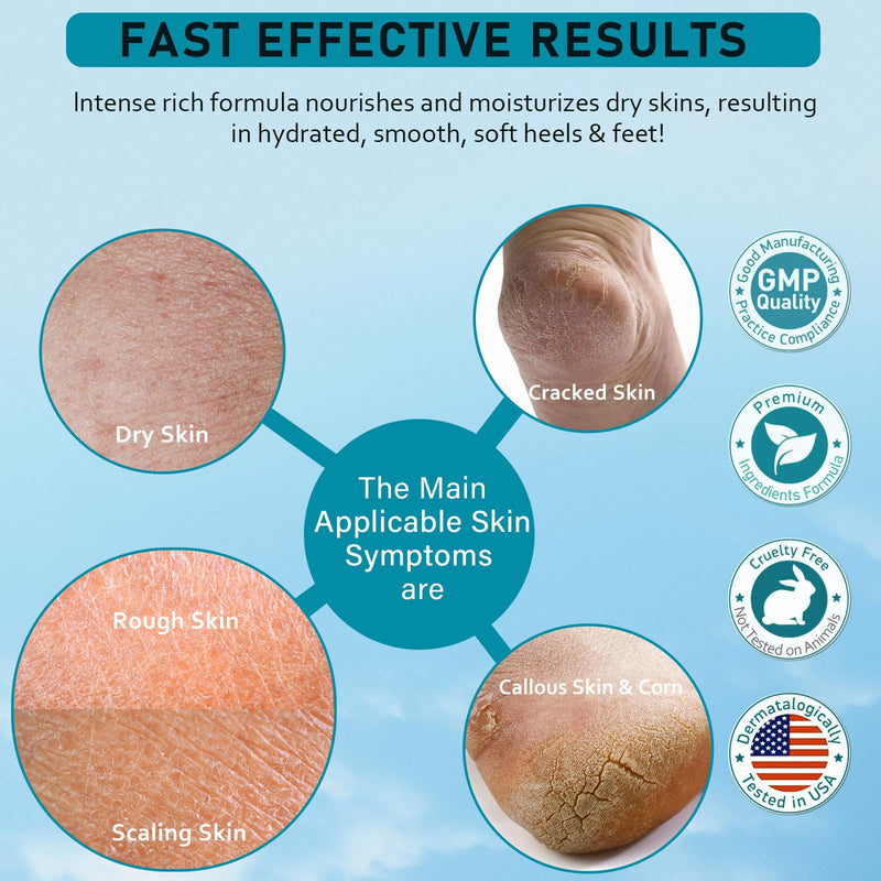 [Australia] - Urea Cream 40 Percent For Feet Maximum Strength - plus Salicylic Acid 2% Foot Cream For Dry Cracked Heels Feet Knees - Dead Skin Cuticle Callus Remover Toenail Softener - Pack of 2 2.65 Ounce (Pack of 2) 