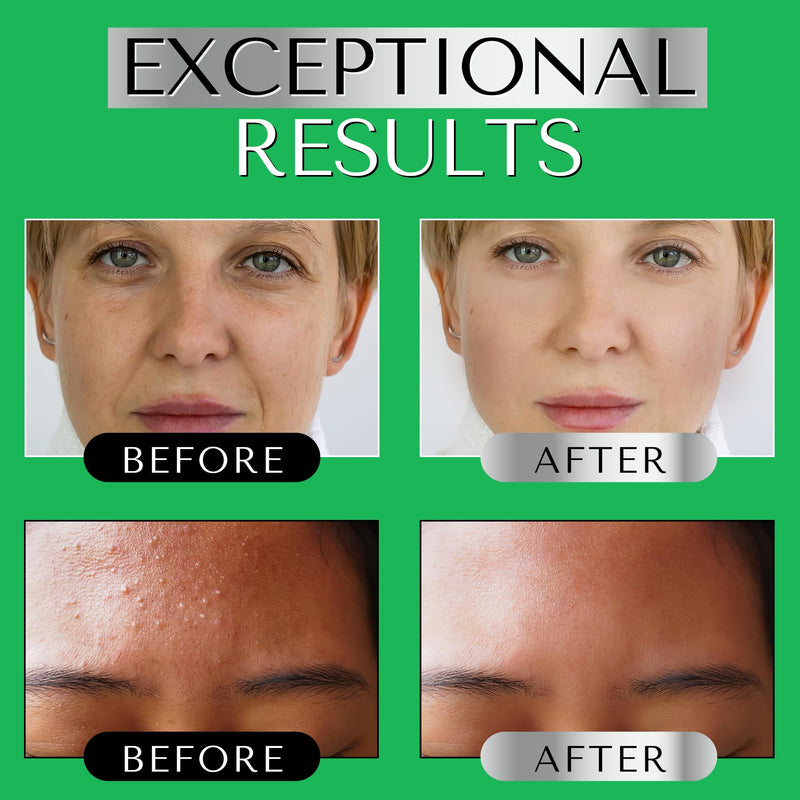 RETINOL SERUM for Face - Anti Aging Night Serum with Hyaluronic Acid & Vitamin E - Wrinkle Reducing, Pore Minimizing Face Serum for Fine Lines, Dark Spots & Uneven Skin Tone DERMAWORKS