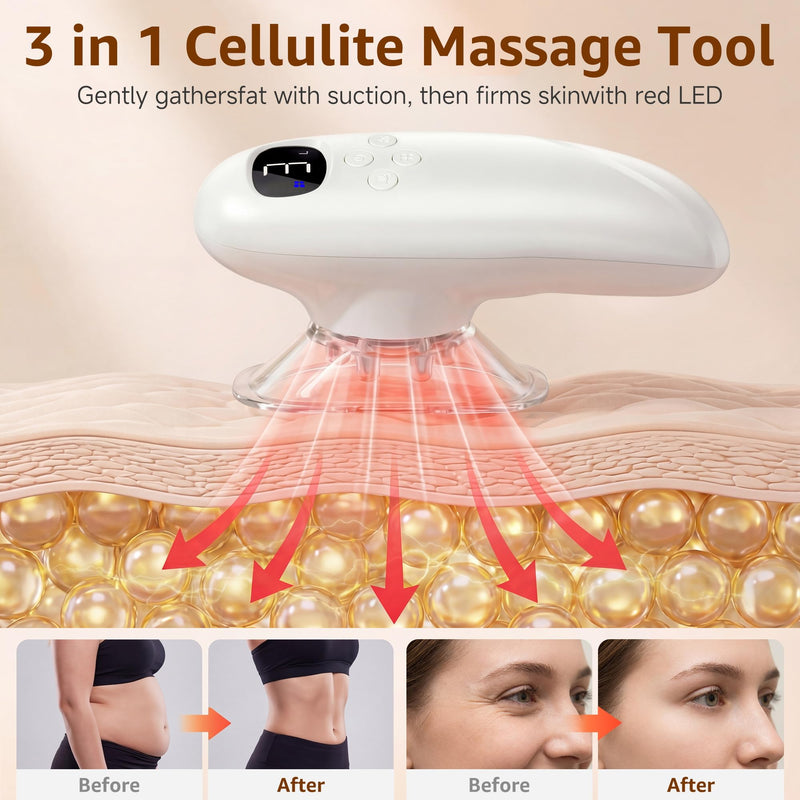 Body Smart Scraping,3 in 1 Body Sculpting Machine,Cellulite Removal Machine,Body Sculptor,Suitable for Legs, Abdomen,Arms, Love Handles,Relieves Muscle Tension and Tightens Skin,cellulite massage tool White