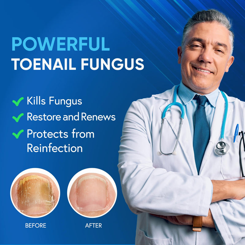 Toenail Fungus Treatment Extra Strength with 25% Undecylenic Acid & Tea Tree Oil, Nail Fungus Treatment for Toenail & Fingernails, Antifungal Nail Treatment for Damaged Nails and Thick Toenails- 2Pcs 0.5 Fl Oz (Pack of 2)