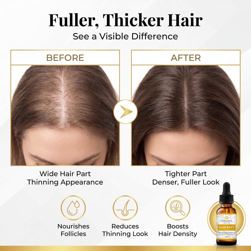 Vitality Extracts Hair Envy - Natural Hair Growth Serum - 100% Pure Essential Oils, 15 Plant Extracts, No Synthetics, No Parabens - Strengthen Hair, Minimize Breakage, Stimulate Follicles