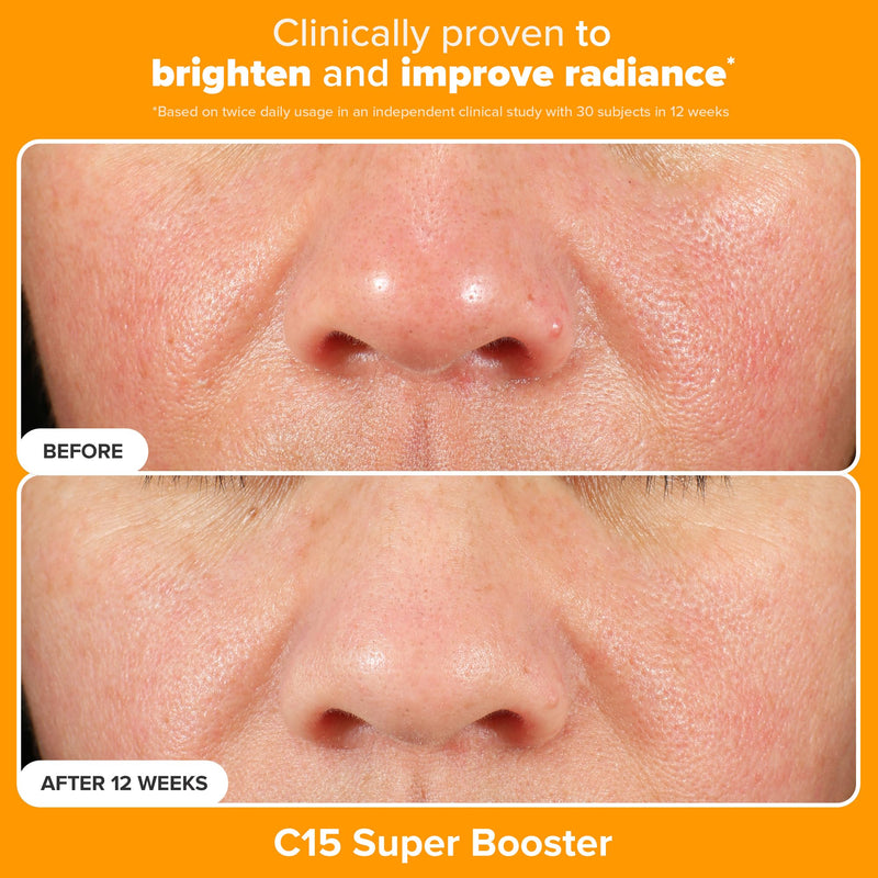 Paula's Choice BOOST C15 Super Booster 15% Vitamin C Face Serum | Daily Serum with Vitamin E & Ferulic Acid for Discoloration & Glow, Fragrance-Free Vitamin C15 (Kit)