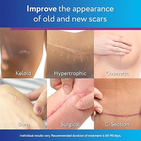 ScarAway 100% Medical-Grade Silicone Scar Gel for Face, Body, Surgical, Burn, Hypertrophic Scars, Keloids and Acne Scar Treatment, 0.71 Ounces, (20 Grams)