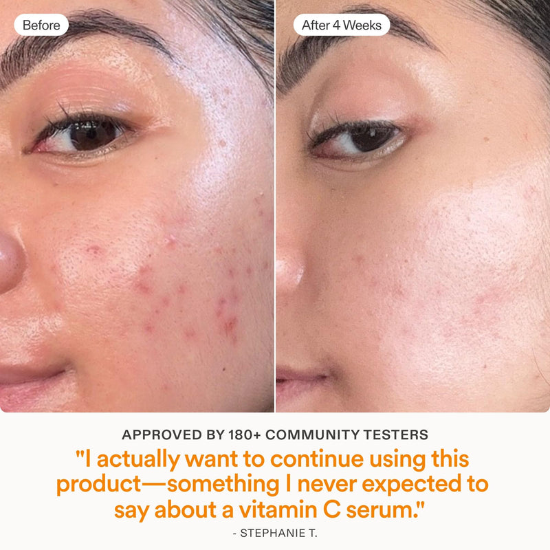 Skinfix Brighten + Firm 15% Vitamin C Serum for Face - Visibly Fades Dark Spots & Fine Lines - Safe for Sensitive & Aging Skin