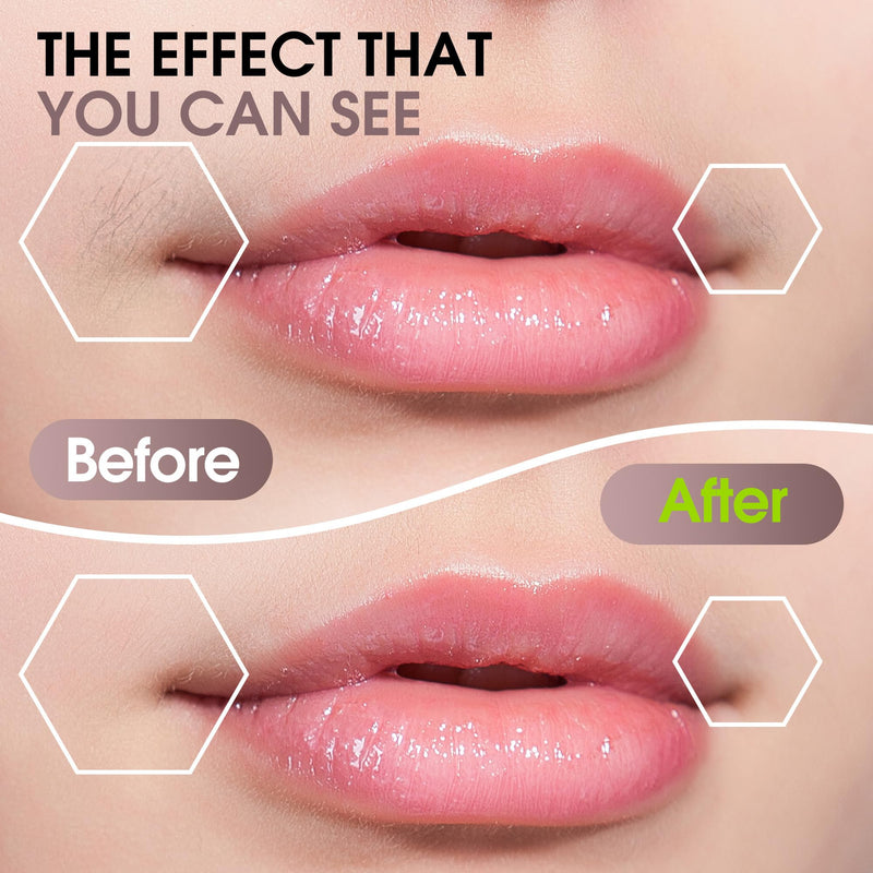 [Australia] - Facial Hair Removal for Women: Electric Hair Removal Device - Rechargeable Painless Face Razor for Chin Upper Lip Peach Fuzz with Light (Rose Gold) Rose Gold 