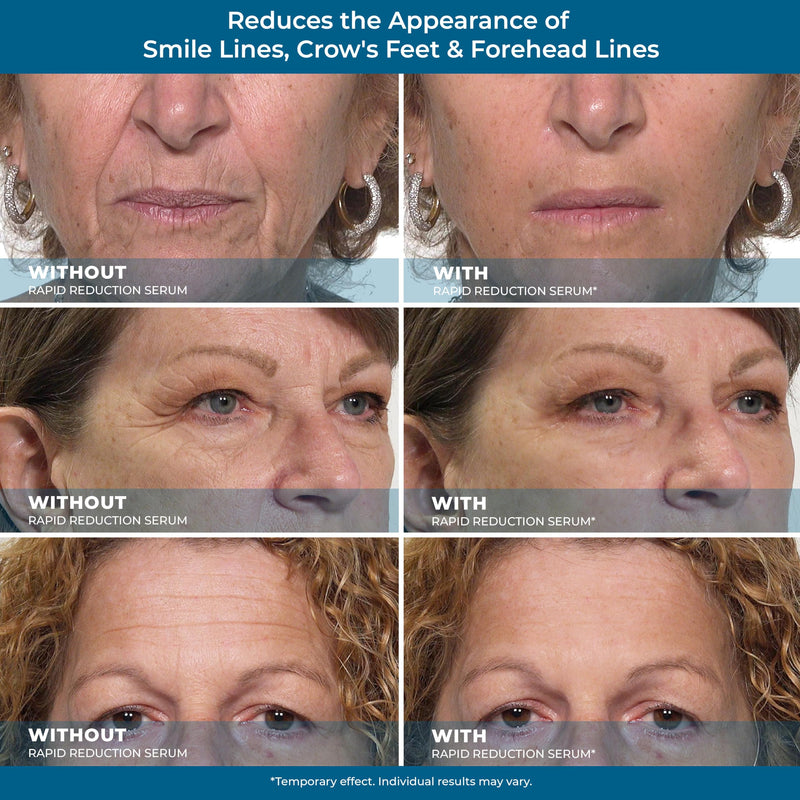[Australia] - Plexaderm Rapid Reduction Eye Serum - Advanced Formula Anti Aging Visibly Reduces Under-Eye Bags, Wrinkles, Dark Circles, Fine Lines & Crow's Feet Instantly Instant Wrinkle Remover for Face 