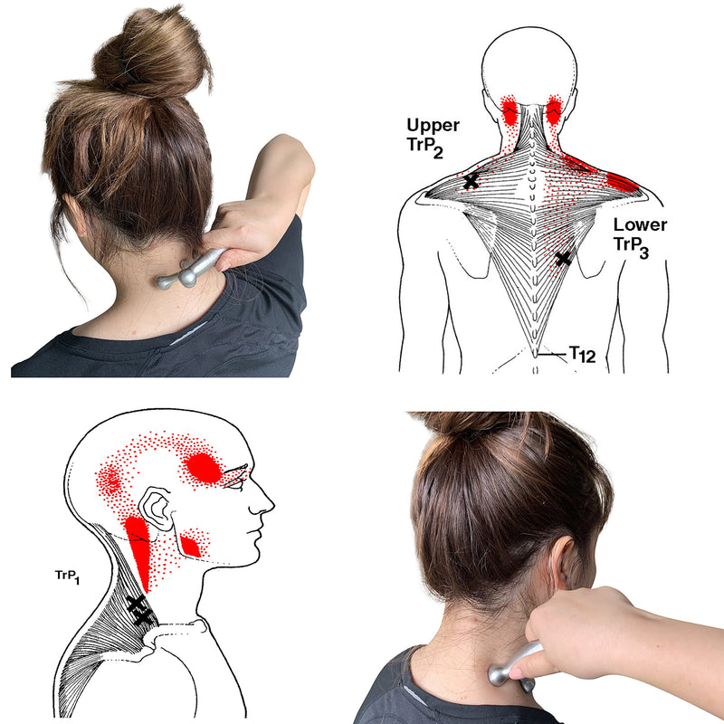 [Australia] - Tennis Elbow Massage Tool, Upper Arm Massage Tool, Myofascial Release Trigger Point Massager (Large) Large 