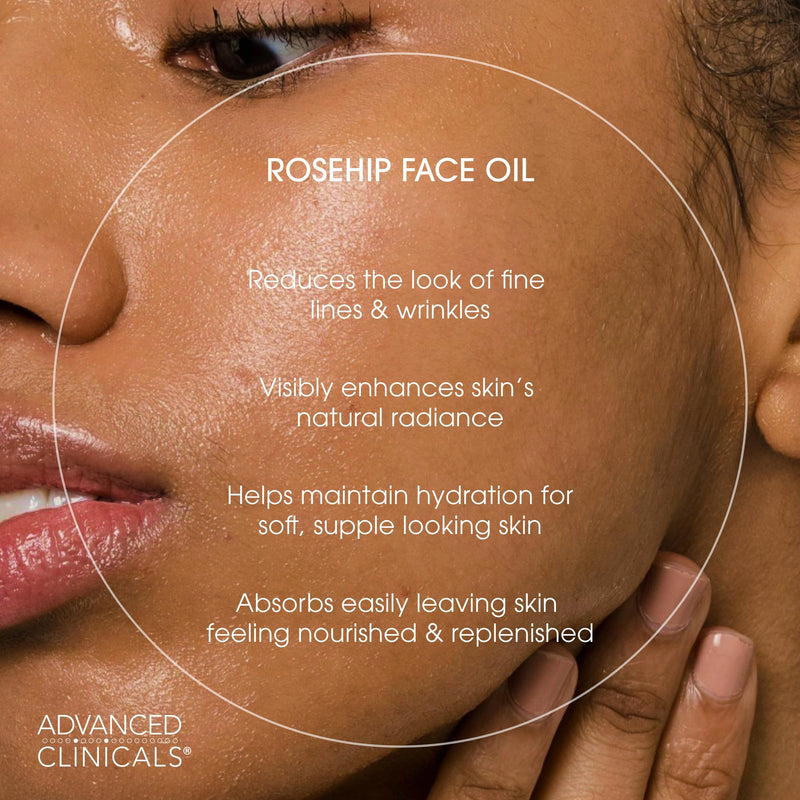 Advanced Clinicals Rosehip Oil For Face With Vitamin E + Botanicals Helps Improve Look Of Dark Spots, Wrinkles, Fine Lines, & Uneven Looking Skin Tone | Moisturizing Skin Care Face Serum, 1.8 Fl Oz 1.8 Fl Oz (Pack of 1) Rosehip Oil Serum