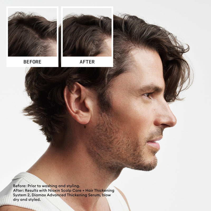 NIOXIN System 2 Scalp Care | Conditioner | Hair Thickening For Natural Hair | Scalp Health | For Natural Hair with Progressed Thinning | Boost Hair Density with Niacinamide & Biotin | Refreshed Scalp 16.9 Fl Oz (Pack of 1)