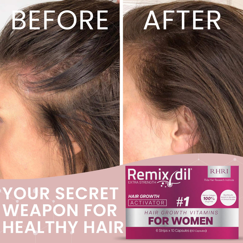 Hair Growth Vitamins Hair Growth Supplements For Women for Thinning Hair | Hair Growth Supplements , Supports Thickness And Strength, Reduces Breakage And Thinning, Healthy Scalp Function 60 Capsules