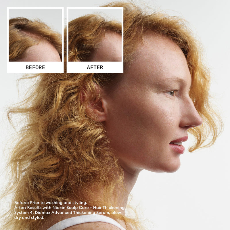 NIOXIN System Kits | Scalp + Hair Thickening | 1 Month Supply | Natural, Colored & Damaged Hair with Light to Progressed Thinning | Strengthen & Boost Hair Density with Niacinamide & Biotin
