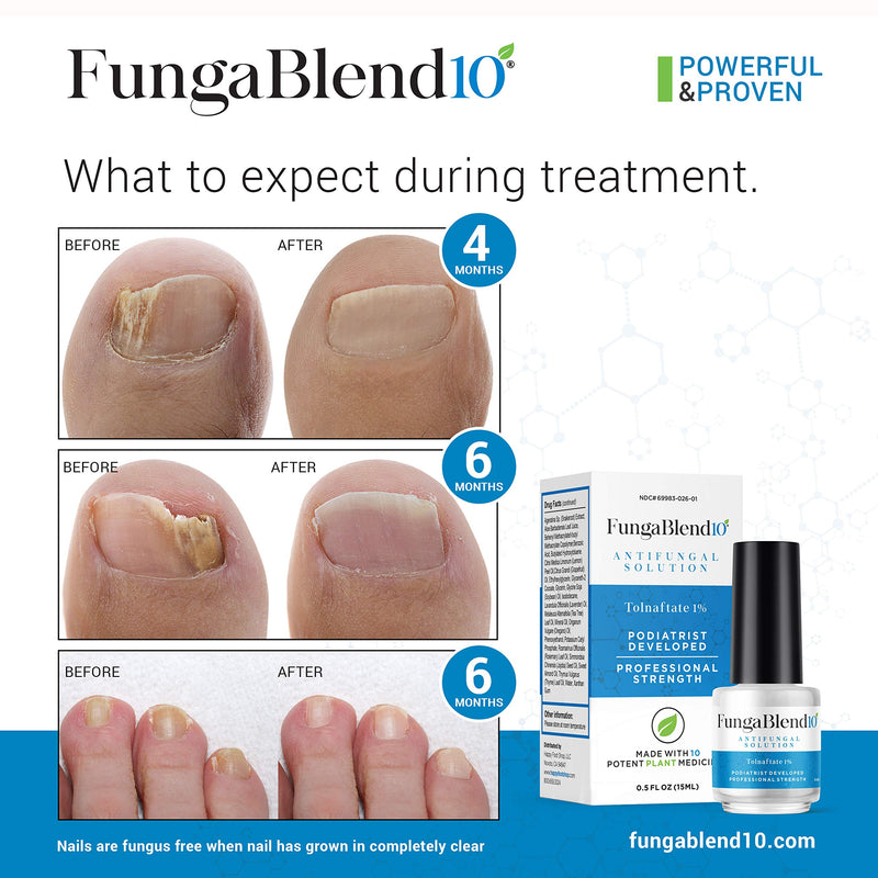 FungaBlend 10 - Antifungal Medication:1% Tolnaftate and 10 Plant Medicines -Toenail Fungus Treatment for Nail Repair Gel, Athletes Foot, Jock Itch, Ringworm -Topical Solution for Toe and Finger Nail