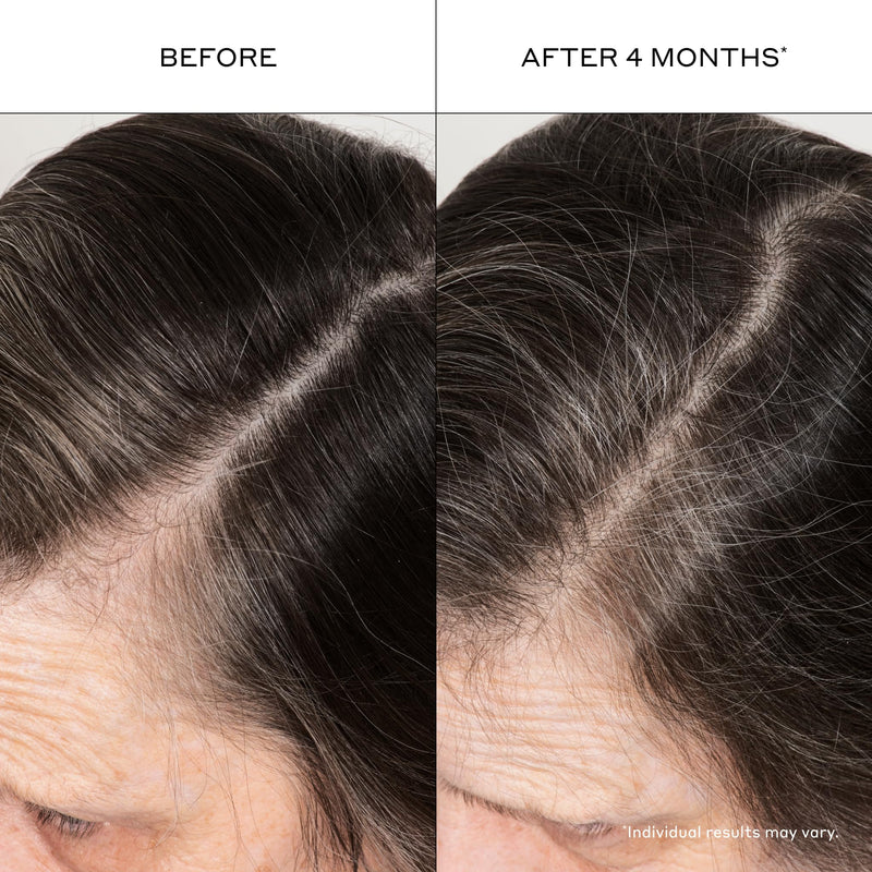 Zenagen Densifying Hair Serum | Boosts Hair Density 1.7 Fl Oz (Pack of 1)