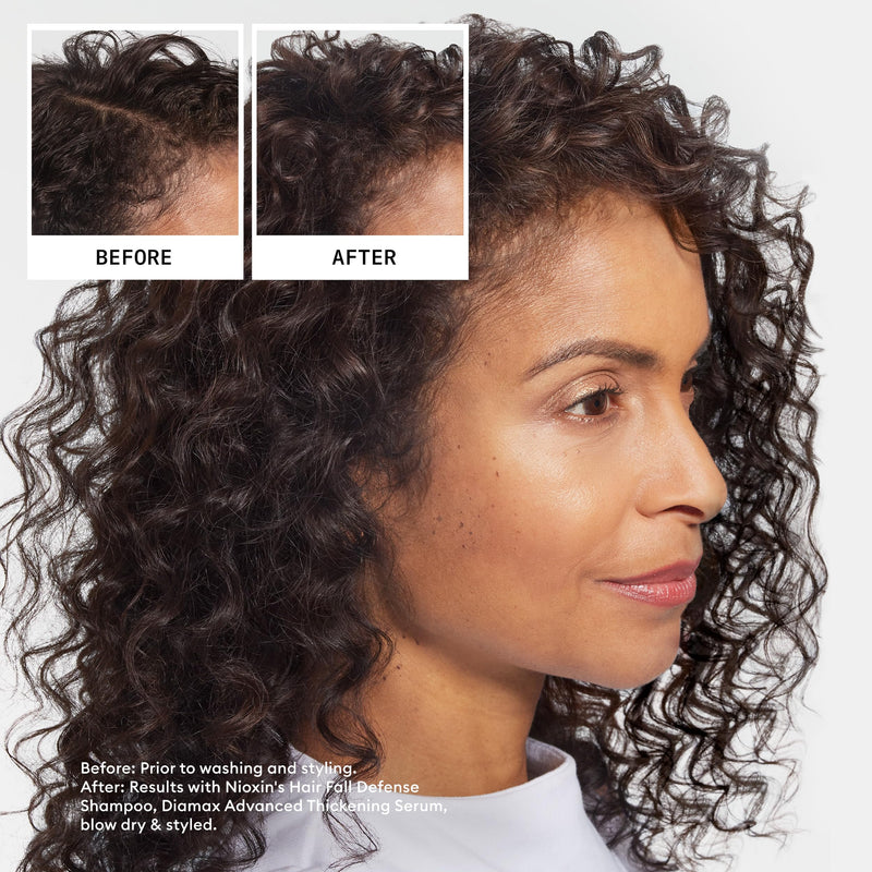 Nioxin Hair Fall Defense Shampoo | Activates Hair Follicles for Visibly Less Hair Loss| With Lauric Acid, Caffeine, Niacinamide and Sandalore 8.1 Fl Oz (Pack of 1)