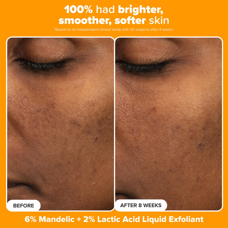 Paula's Choice BOOST C15 Super Booster 15% Vitamin C Face Serum | Daily Serum with Vitamin E & Ferulic Acid for Discoloration & Glow, Fragrance-Free Vitamin C15 (Kit)