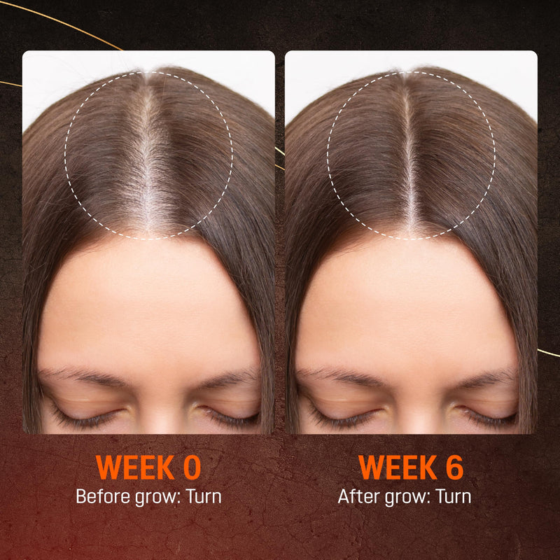 Abera Redensyl Hair Growth Serum for Fuller-Looking Hair, 1 Serum | 2% Redensyl, Ginseng & Onion Extract for Hair Thickening, Thinning Hair, Fast Absorbing, Hair Care for Men & Women A. 1 Serum