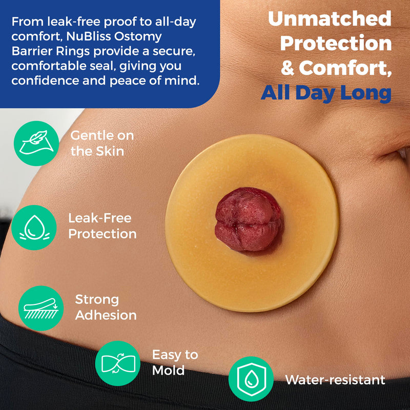 [Australia] - NuBliss Moldable Ostomy Barrier Ring ‚Äì 10-Pack, 4mm Thick ‚Äì Leak-Free Hydrocolloid Skin Adhesive Ostomy Supplies ‚Äì Flexible Stoma Protector Seal for Colostomy & Ileostomy Bags Standard Adhesive 
