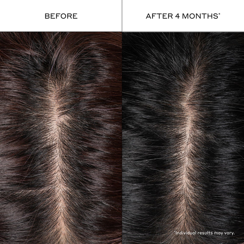 Zenagen Densifying Hair Serum | Boosts Hair Density 1.7 Fl Oz (Pack of 1)