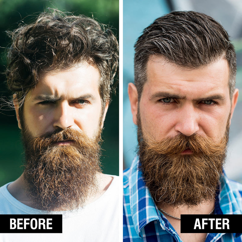 [Australia] - Beard Club - Beard Oil - Mountain Woodsman Beard Oil Men - Ideal beard care and beard oil (Beard Oil) for men - 100ml 