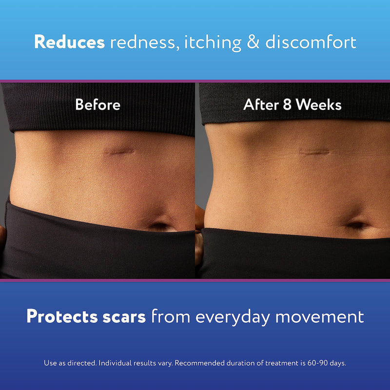 [Australia] - ScarAway Silicone Scar Gel, Helps Improve Size, Color & Texture of Hypertrophic & Keloid Scars from Injury, Burns & Surgery, Water Resistant, 10g (0.35 Oz) 