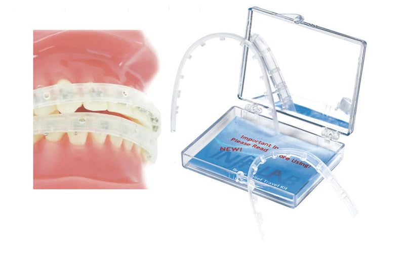 [Australia] - Orthodontic Braces Lip Guard Protector Shield (1 Set - Upper - Lower Teeth) with Instructions by AdentalZ 