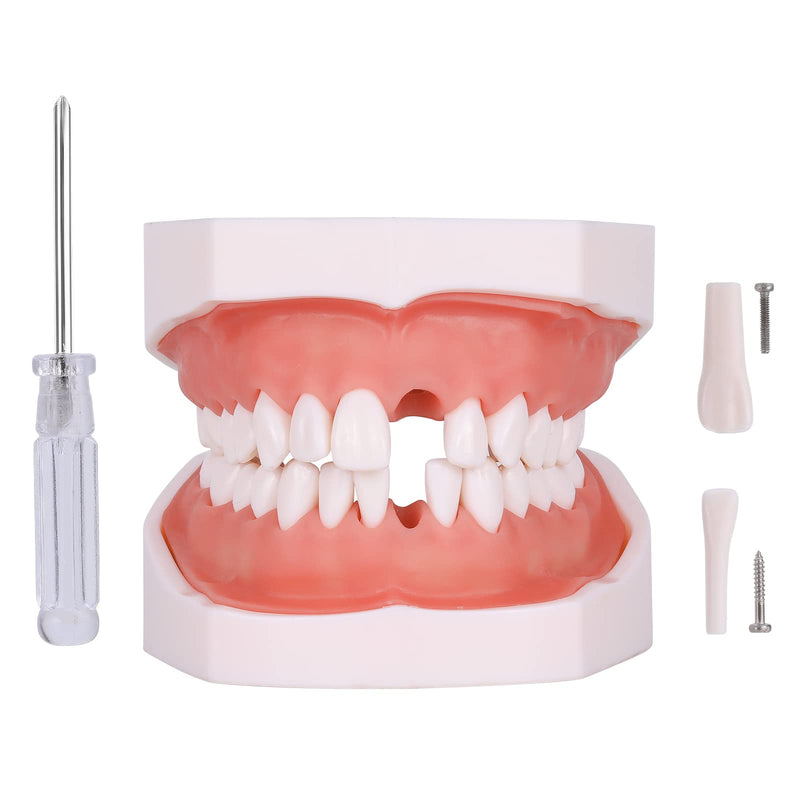 Typodont Teeth Model - Removable Tooth Teach Practice Model Teaching Study Typodont Demonstration Model Come with a Small Screwdriver 28 teeth