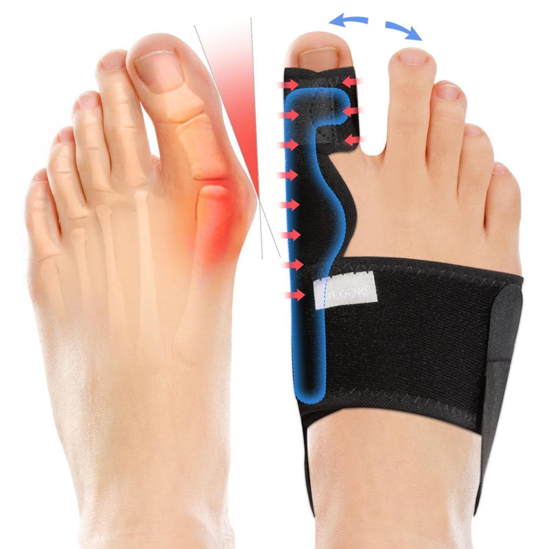 [Australia] - Fitgeno Bunion Corrector Women & Men Big Toe: Foot Straightener Splint Brace - Adjustable Bunyan Correction Orthopedic for Hallux Valgus Pain Relief 2 Pcs Black 