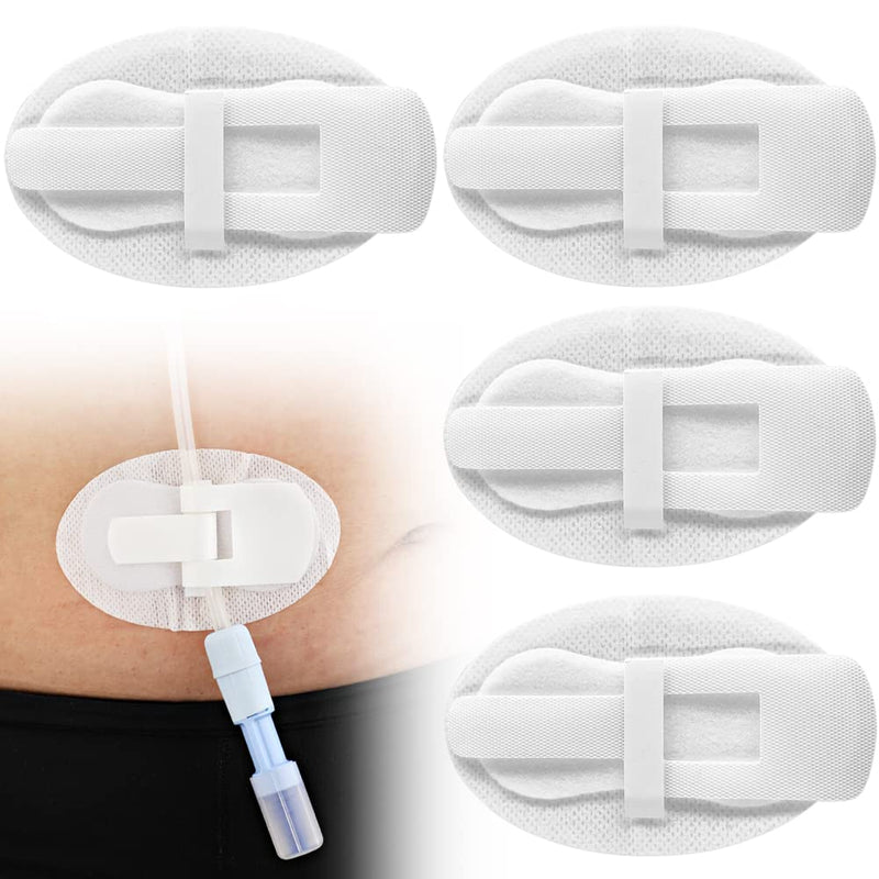 [Australia] - Feeding Tube Cover Catheter Fixiation J Peg Tubing Pads Supplies, Foley Drain Tubing Adhesive Patch Peritoneal Dialysis Stickers Stabilization Device Accessories(Pack of 5) Oval Cover-5pcs 