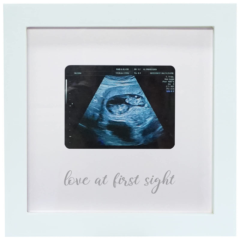 [Australia] - Love at First Sight Ultrasound Picture Frames, Sonogram Picture Frame, Pregnancy Announcement for Grandparents, Baby Announcement Ideas Ultrasound Photo Frame Nursery Décor, White Love at First Sight - White 