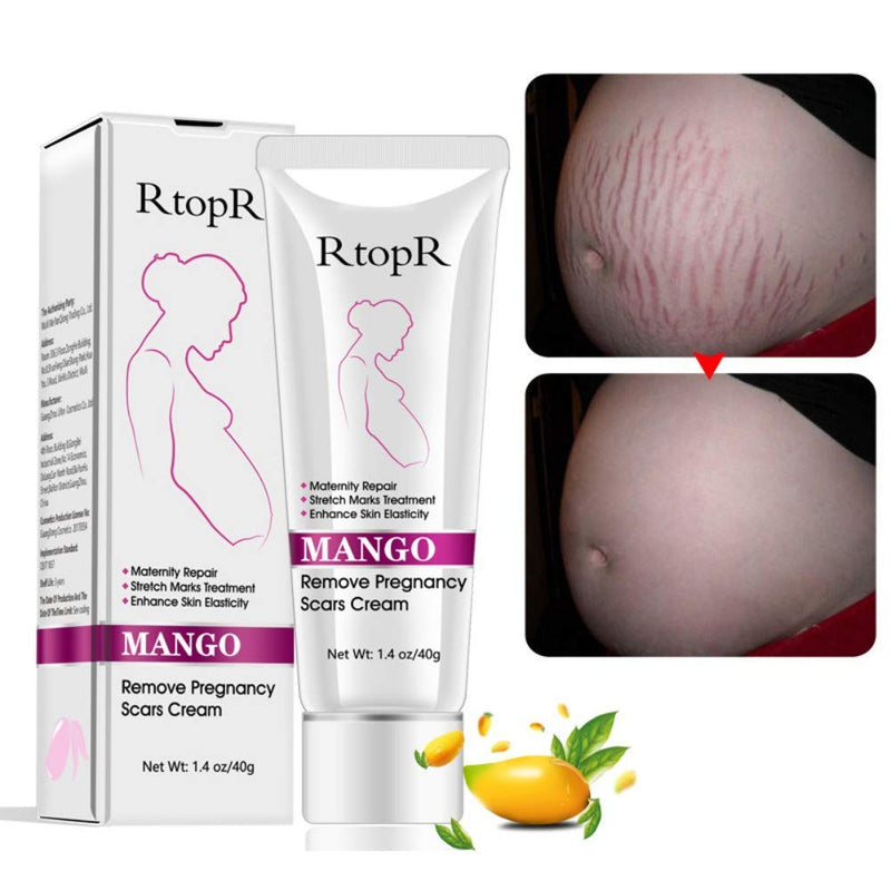 [Australia] - Mango Stretch Marks and Scar Cream, Stretch Marks and Scar Removal Cream for Pregnancy, Stretch Marks Scar Belly Creams for Wrinkles, Obesity Fat Stretch Mark Moisturizing, Remove Marks (40g) 