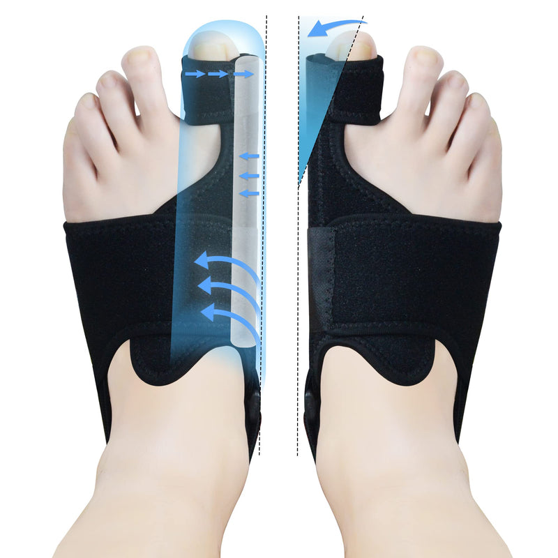 [Australia] - 1 Pair Bunion Corrector for Women & Men, Night Bunion Splint, Big Toe Straightener, Bunion Brace for Pain Relief Black One Size 
