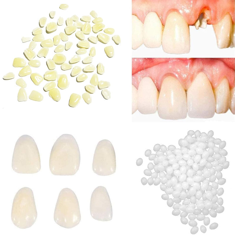 [Australia] - Tooth Repair Kit-Thermal Fitting Beads Granules and Fake Teeth for Temporary Fixing Missing and Broken Tooth，Replace a Missing Tooth in Minutes for Women and Man (Natural Yellow) 